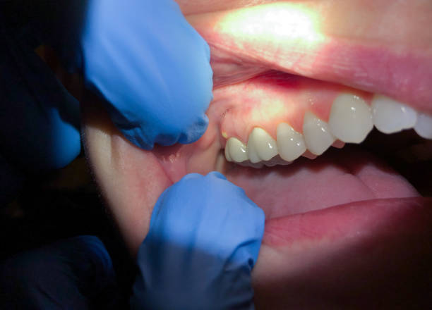 Best Emergency Treatment for Jaw Pain or Injury in Hallam, PA