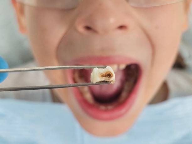 Best Emergency Treatment for Oral Infections in Hallam, PA